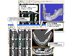 手術シュミレーション